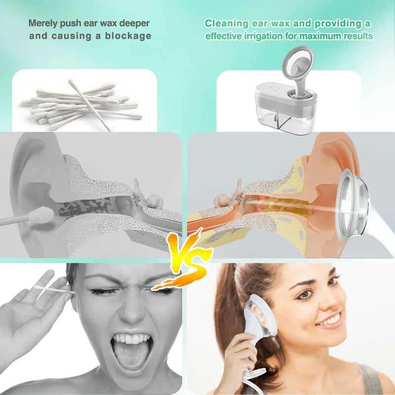 Electric Ear Water Cleaner Earwax Ear Wax Removal Irrigation System Ear Washer Cleaning Ear Cleaner Kit for Adults Kid 400/500ML